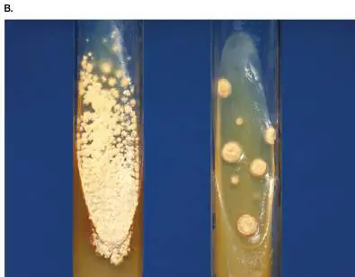 Figure from Chapter 26, Microbiology: An Evolving Science 6e