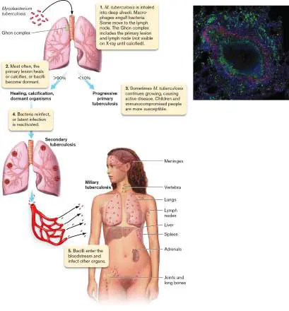 Figure from Chapter 26, Microbiology: An Evolving Science 6e