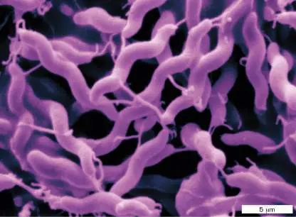Figure from Chapter 26, Microbiology: An Evolving Science 6e