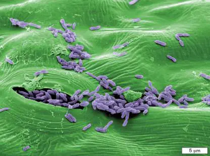 Figure from Chapter 26, Microbiology: An Evolving Science 6e