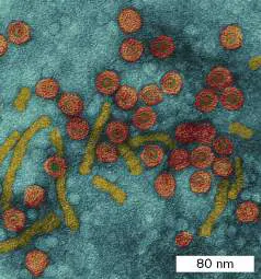 Figure from Chapter 26, Microbiology: An Evolving Science 6e