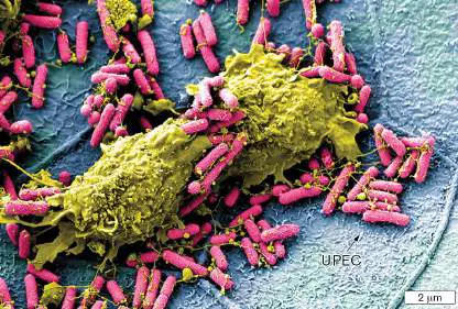 Figure from Chapter 26, Microbiology: An Evolving Science 6e