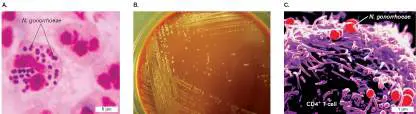 Figure from Chapter 26, Microbiology: An Evolving Science 6e