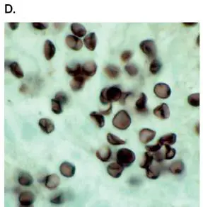 Figure from Chapter 26, Microbiology: An Evolving Science 6e