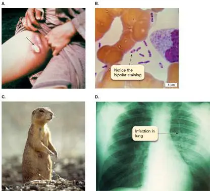 Figure from Chapter 26, Microbiology: An Evolving Science 6e