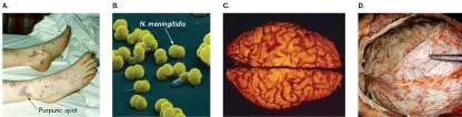 Figure from Chapter 26, Microbiology: An Evolving Science 6e