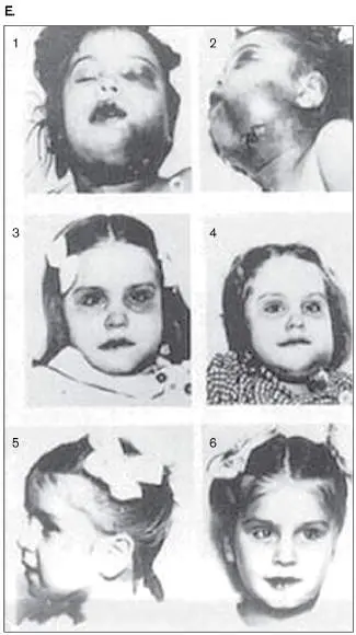 Figure from Chapter 27, Microbiology: An Evolving Science 6e