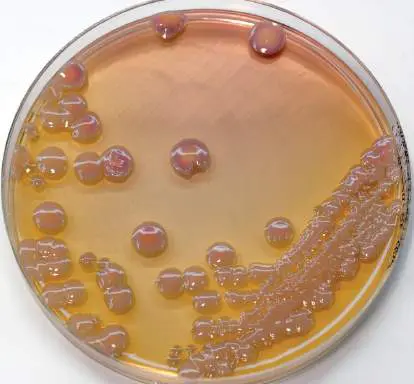 Figure from Chapter 27, Microbiology: An Evolving Science 6e