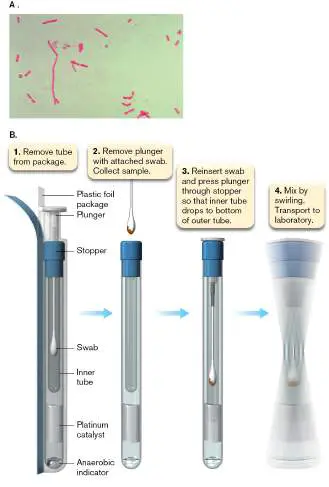 Figure from Chapter 28, Microbiology: An Evolving Science 6e