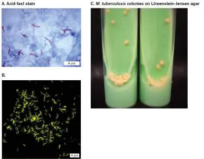 Figure from Chapter 28, Microbiology: An Evolving Science 6e