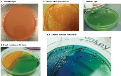 Figure from Chapter 28, Microbiology: An Evolving Science 6e