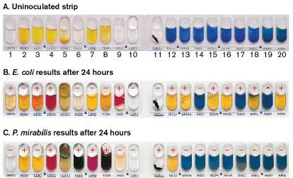 Figure from Chapter 28, Microbiology: An Evolving Science 6e