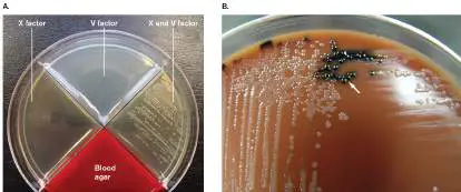 Figure from Chapter 28, Microbiology: An Evolving Science 6e