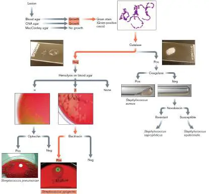Figure from Chapter 28, Microbiology: An Evolving Science 6e
