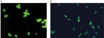 Figure from Chapter 28, Microbiology: An Evolving Science 6e