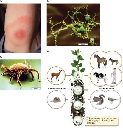 Figure from Chapter 28, Microbiology: An Evolving Science 6e