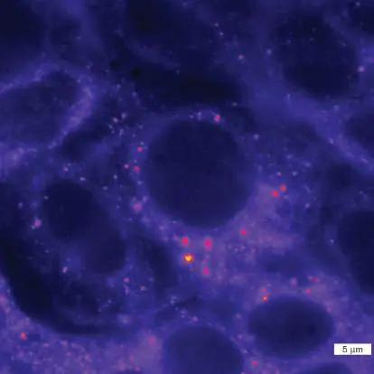 Figure from eAppendix 4, Microbiology: An Evolving Science 6e