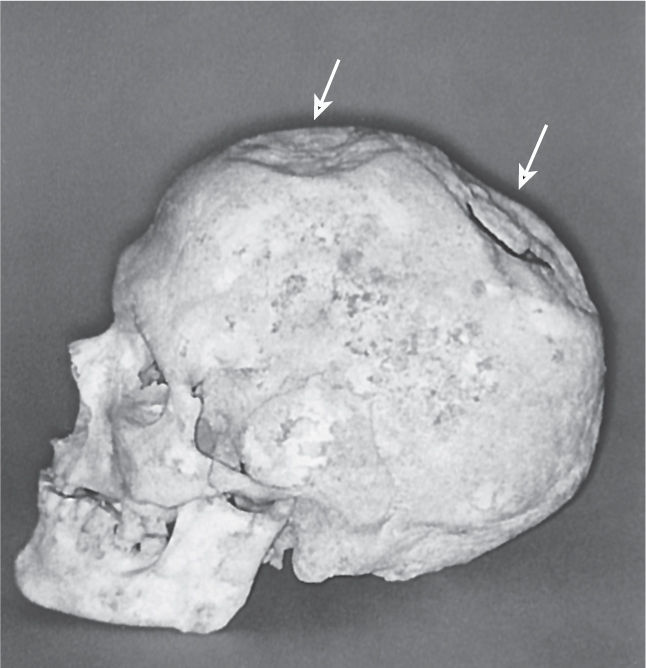 Ch 1 fig (p. 0)