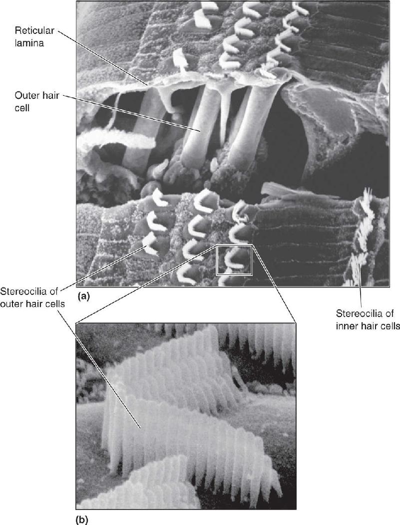 Ch 11 fig (p. 0)