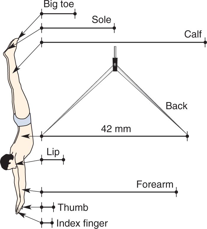 Ch 12 figure