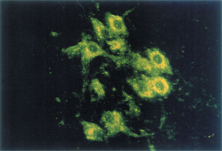 Ch 15 fig (p. 0)