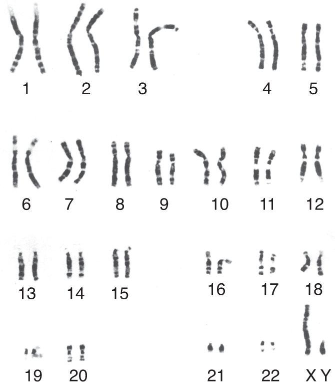 Ch 17 fig (p. 0)