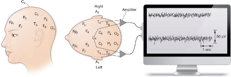Ch 19 fig (p. 0)