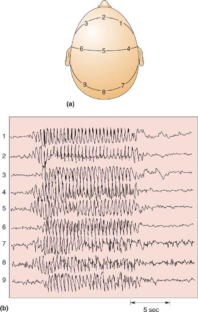 Ch 19 fig (p. 0)