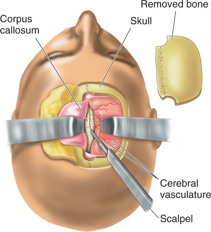 Ch 20 fig (p. 0)